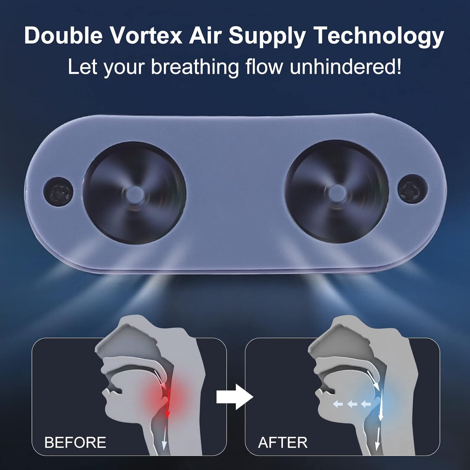 Travel Device Sleep Apnea Portable – Anti-Snoring